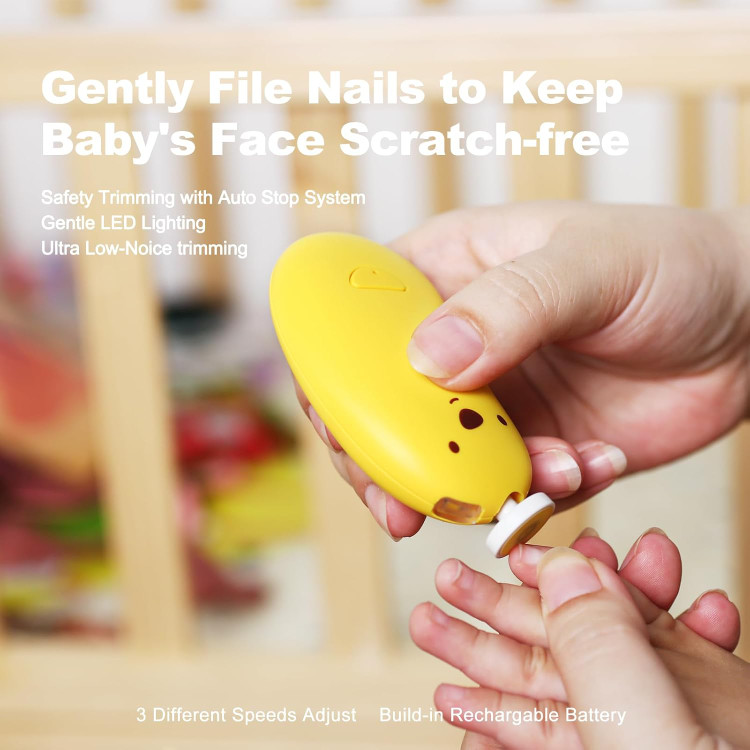 سیسمونی نوزاد